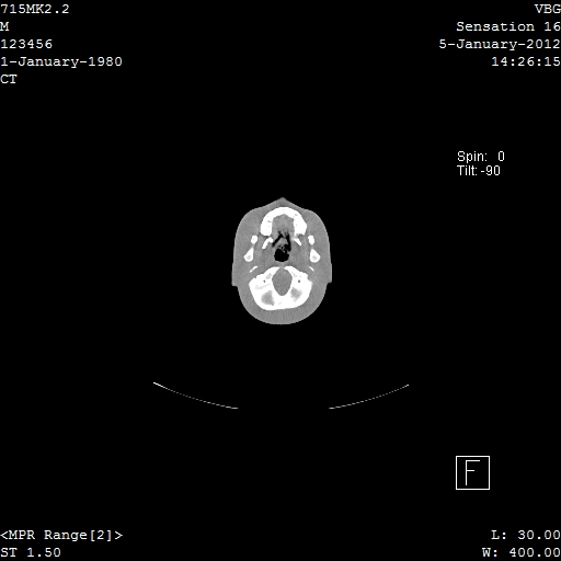 SPoRT CT Image 3