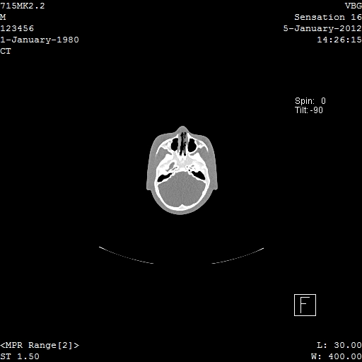 SPoRT CT Image 5