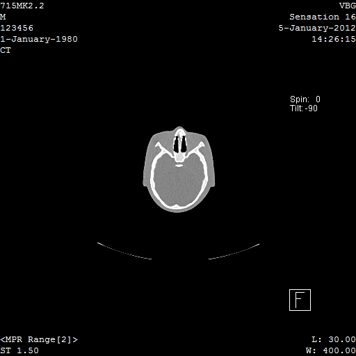 SPoRT CT Image 6