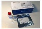 Biocard Helicobacter pylori Urease Test - 3018945