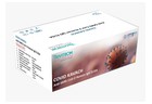 COVID KAVACH Anti-SARS-CoV-2 Human IgG ELISA - 30201299
