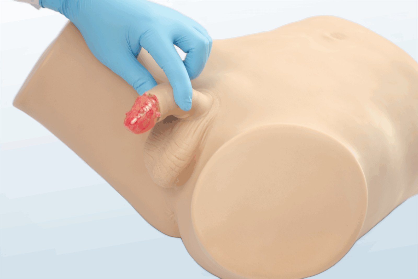 Male STD Examination Model - PC-MEE015