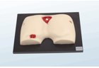 Pressure Ulcer/Bedsore Model - PC-NUE006.03