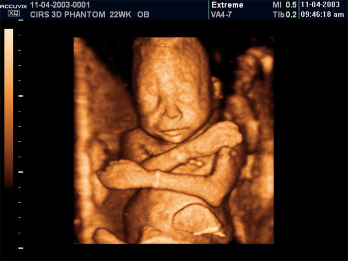 20 week ultrasound 4d