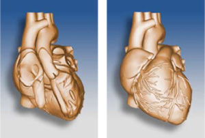 Ultrasound Heart Phantom CIRS 067 heart detail