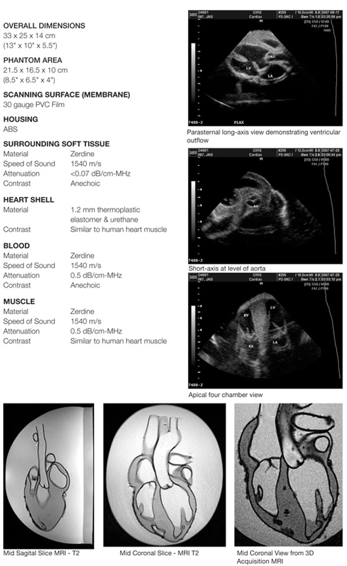 Ultrasound Heart Phantom CIRS 067 Specifications