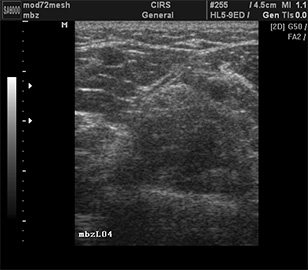 Vascular Access Training Phantom Kit CIRS 072 teaching training ...